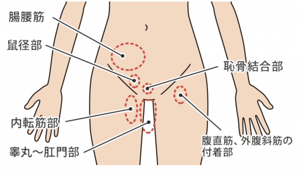 部 痛み 鼠径