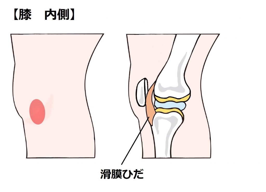 鵞足炎 がそくえん ダエンからマル Lab ラボラトリー ダエンからマル施術院