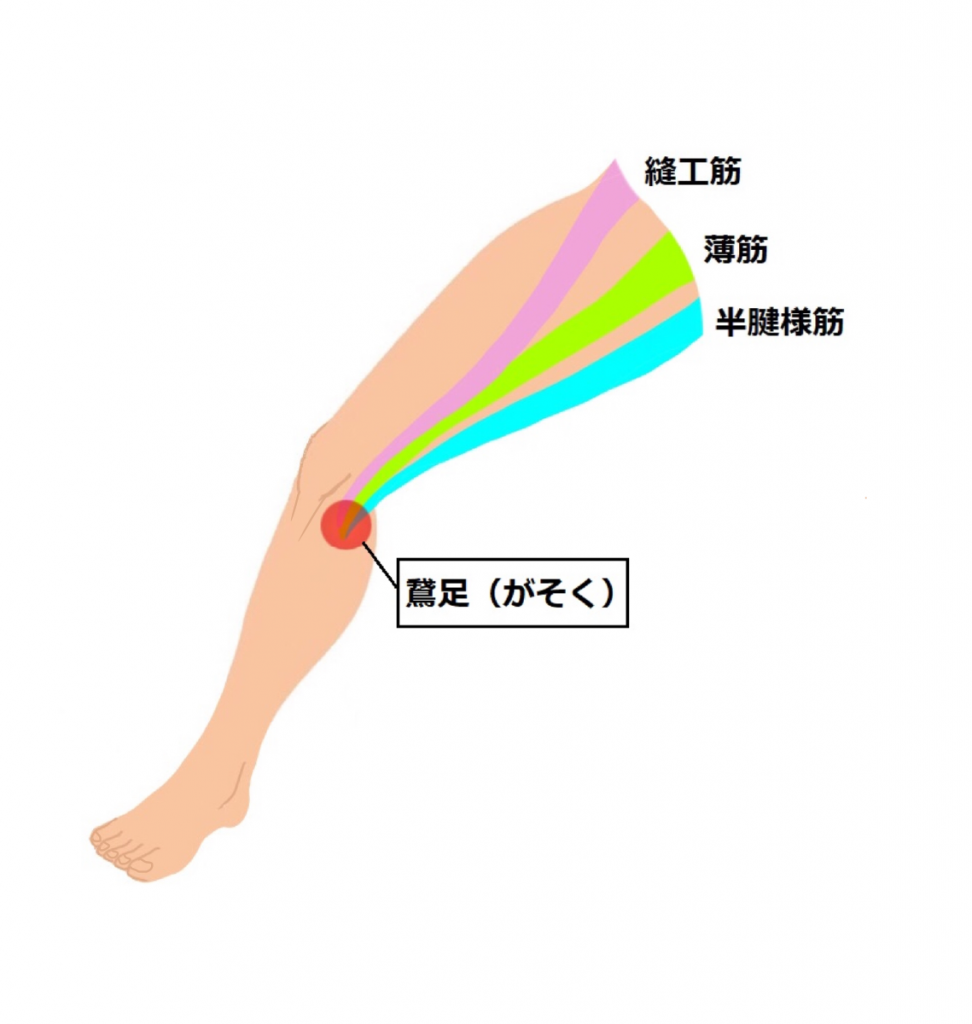 鵞足炎 がそくえん ダエンからマル Lab ラボラトリー ダエンからマル施術院