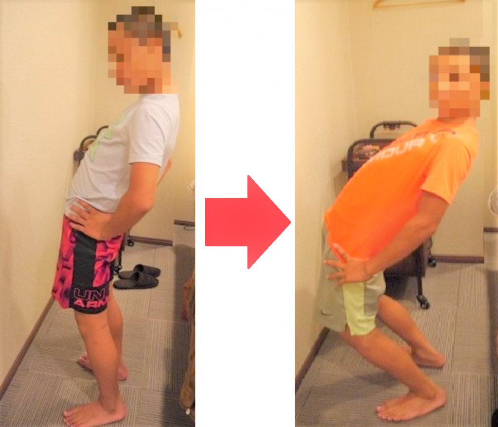数か月の安静 と言われていた腰椎分離症 6回で施術卒業 通院レポート ダエンからマル施術院 数か月の安静 と言われていた腰椎分離症 6回で施術卒業 通院レポート ダエンからマル施術院